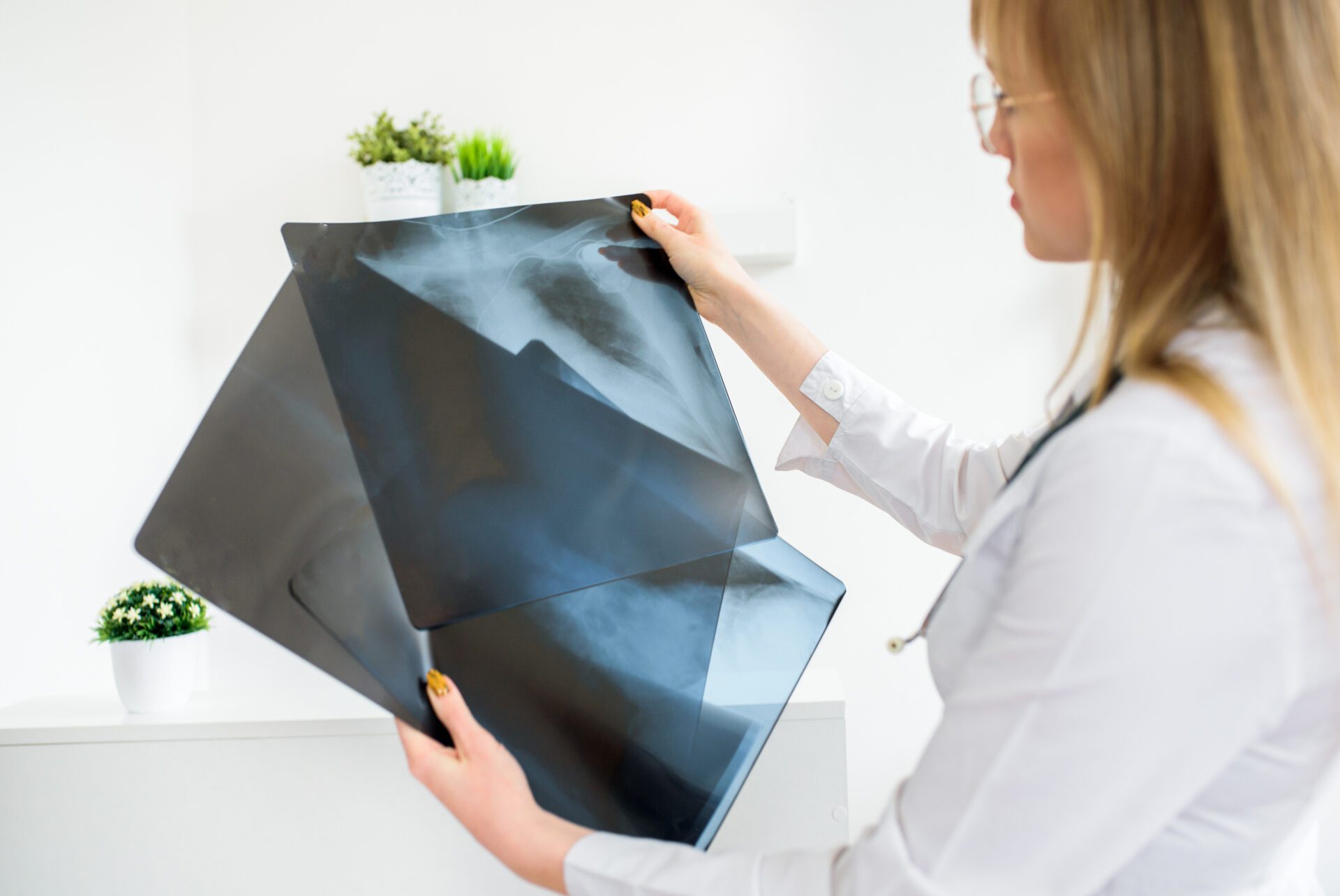 Person holding x-ray scans call-duty